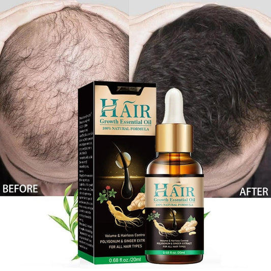 Hair growth Serum 30ml each (pack of 2)
